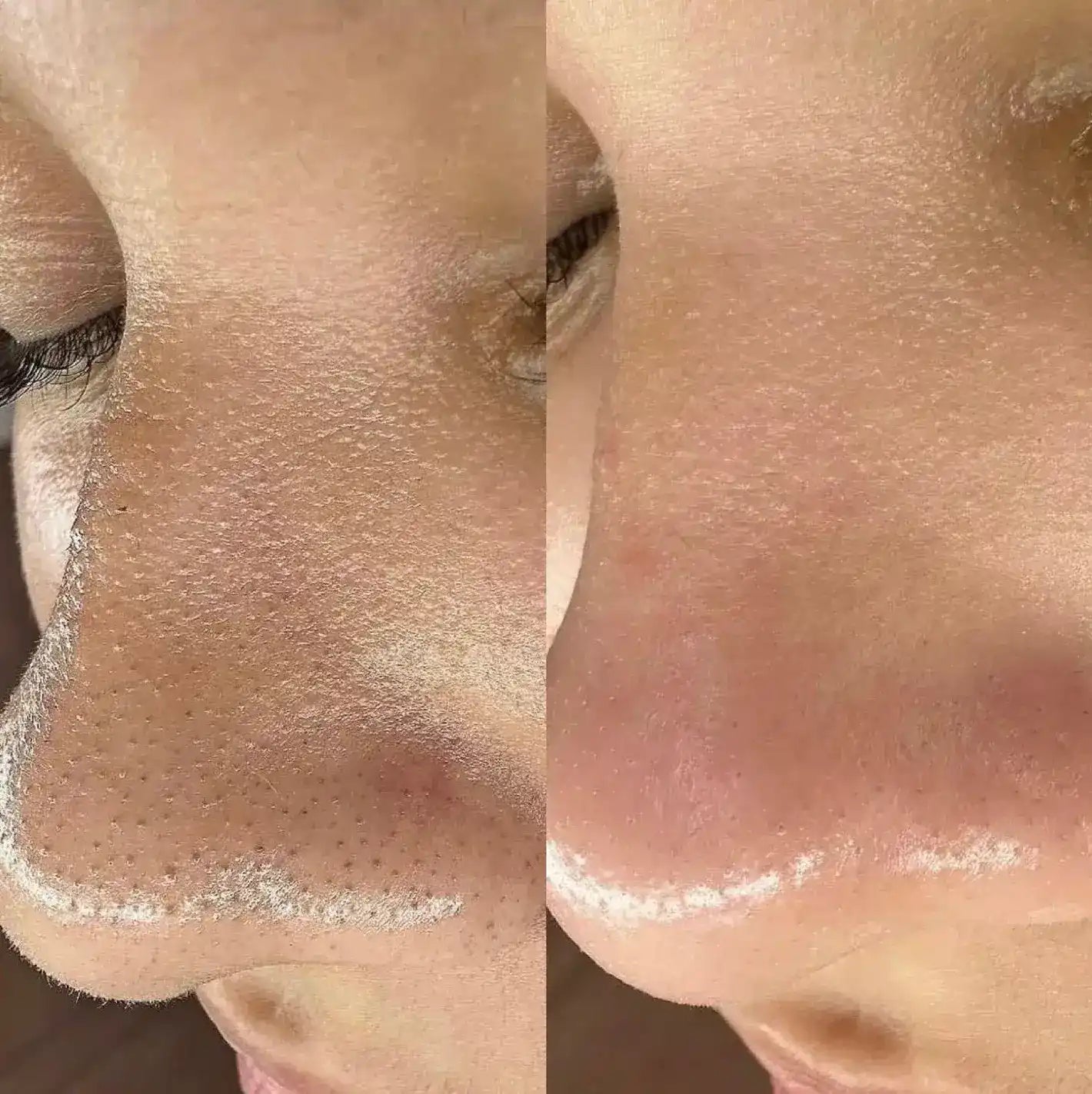 Dr. Melaxin Ampolla Rice & Black Rice – Limpieza profunda🥇